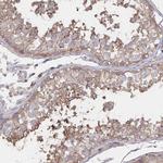 PGAP2 Antibody in Immunohistochemistry (Paraffin) (IHC (P))
