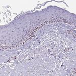IRF1 Antibody in Immunohistochemistry (Paraffin) (IHC (P))