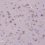 T4S20 Polyclonal Antibody