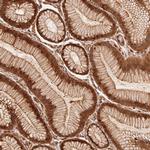 TNIP2 Antibody in Immunohistochemistry (Paraffin) (IHC (P))