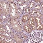 HIRIP3 Antibody in Immunohistochemistry (Paraffin) (IHC (P))
