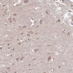 PREPL Polyclonal Antibody