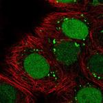 HELLS Polyclonal Antibody