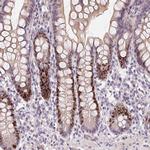 HELLS Antibody in Immunohistochemistry (Paraffin) (IHC (P))