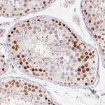 HELLS Antibody in Immunohistochemistry (Paraffin) (IHC (P))