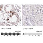 HELLS Antibody in Immunohistochemistry (IHC)