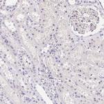 HELLS Antibody in Immunohistochemistry (IHC)