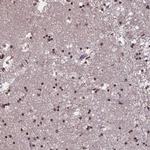 TEB4 Polyclonal Antibody