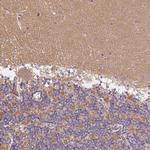 GDAP1L1 Antibody in Immunohistochemistry (Paraffin) (IHC (P))
