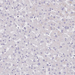 ITLN1 Antibody in Immunohistochemistry (Paraffin) (IHC (P))