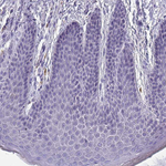 ITLN1 Polyclonal Antibody