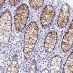 ITLN1 Antibody in Immunohistochemistry (IHC)