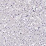 ITLN1 Antibody in Immunohistochemistry (IHC)