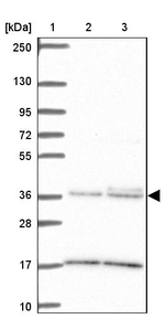 ITLN1 Antibody in Western Blot (WB)