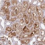 NECAP1 Polyclonal Antibody