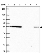 eIF3d Antibody in Western Blot (WB)