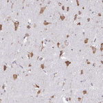 RPS3 Antibody in Immunohistochemistry (Paraffin) (IHC (P))