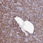RPS3 Antibody in Immunohistochemistry (Paraffin) (IHC (P))