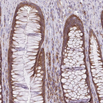 RPS3 Antibody in Immunohistochemistry (Paraffin) (IHC (P))