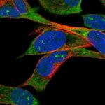 TMEM108 Polyclonal Antibody