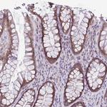 TMEM108 Antibody in Immunohistochemistry (Paraffin) (IHC (P))