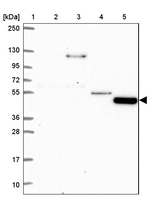TMEM108 Antibody in Western Blot (WB)