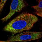 RPL27A Polyclonal Antibody