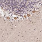 RPL27A Antibody in Immunohistochemistry (Paraffin) (IHC (P))