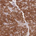 RPL27A Antibody in Immunohistochemistry (Paraffin) (IHC (P))