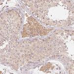 RPL27A Antibody in Immunohistochemistry (Paraffin) (IHC (P))