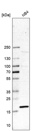 RPL27A Antibody in Western Blot (WB)