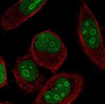 ZNF860 Polyclonal Antibody