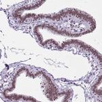 ZNF860 Antibody in Immunohistochemistry (Paraffin) (IHC (P))