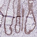 ZNF860 Antibody in Immunohistochemistry (Paraffin) (IHC (P))