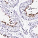 C11orf42 Polyclonal Antibody