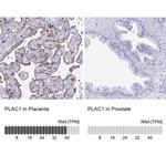 PLAC1 Antibody in Immunohistochemistry (IHC)