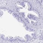 PLAC1 Antibody in Immunohistochemistry (IHC)