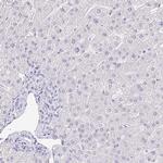 KRTDAP Antibody in Immunohistochemistry (Paraffin) (IHC (P))