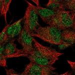 FNDC4 Polyclonal Antibody