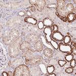 FNDC4 Antibody in Immunohistochemistry (Paraffin) (IHC (P))