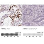 HSF5 Polyclonal Antibody