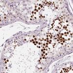 HSF5 Antibody in Immunohistochemistry (IHC)