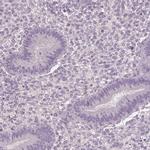 HSF5 Antibody in Immunohistochemistry (IHC)