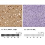 SGTB Antibody in Immunohistochemistry (IHC)
