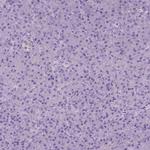 SGTB Antibody in Immunohistochemistry (IHC)