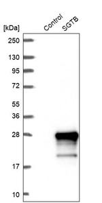 SGTB Antibody in Western Blot (WB)