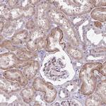 ARVCF Antibody in Immunohistochemistry (Paraffin) (IHC (P))