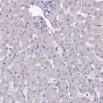 ARVCF Antibody in Immunohistochemistry (Paraffin) (IHC (P))