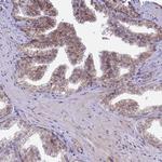 ARVCF Antibody in Immunohistochemistry (Paraffin) (IHC (P))