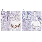 HDGFL1 Polyclonal Antibody